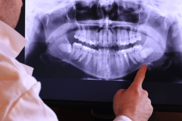 Best Root Canal Emergency Dentist  in Brielle, NJ