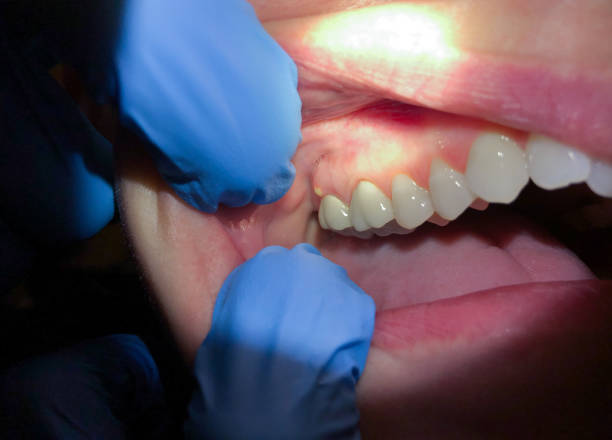 Best Urgent Tooth Repair  in Brielle, NJ
