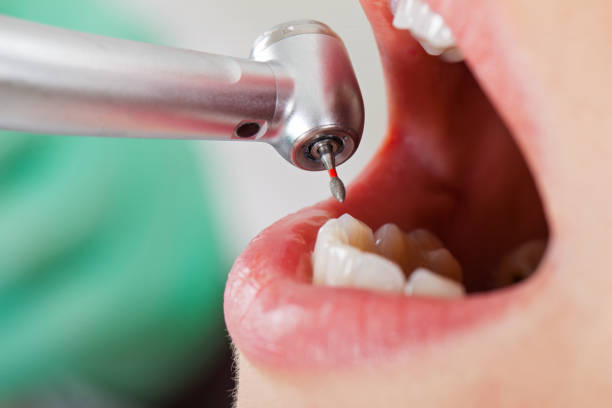 Best Emergency Tooth Extraction  in Brielle, NJ